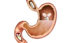 Пробиотици